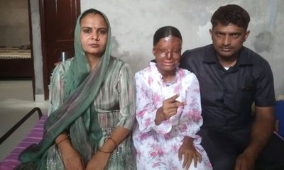 ಆಸಿಡ್‌ ದಾಳಿ ಸಂತ್ರಸ್ತೆಗೆ ಪಿಯುಸಿಯಲ್ಲಿ ಶೇ.95.6 ಅಂಕ