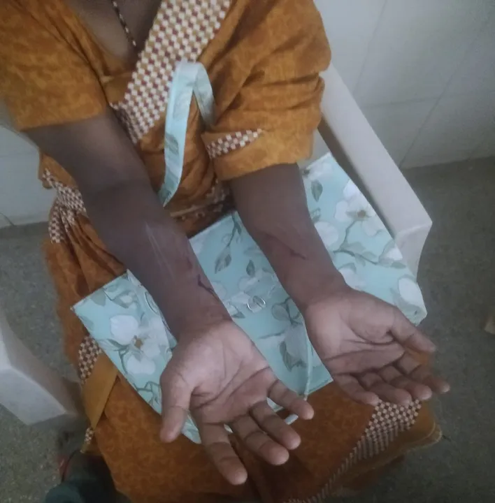 Anganwadi worker attacked: ಬಿ.ವಡ್ಡಹಳ್ಳಿ ಗ್ರಾಮದಲ್ಲಿ ಅಂಗನವಾಡಿ ಕಾರ್ಯಕರ್ತೆ ಮೇಲೆ ಹಲ್ಲೆ, ಜೀವ ಬೆದರಿಕೆ!