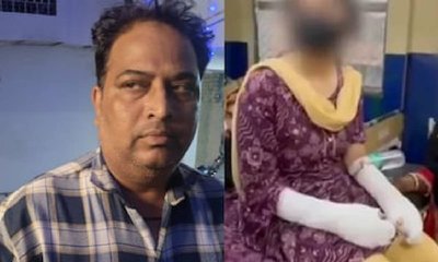 ಆಸಿಡ್‌ ದಾಳಿ ಕೇಸ್‌; ಯುವತಿಯ ತಂದೆ ಮೇಲೆ ಬಿತ್ತು ಕೇಸ್‌