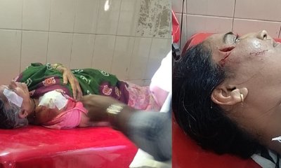 ಬೀದಿ ನಾಯಿಗಳ ದಾಳಿಗೆ ಸೇಡಂ ಜನ ತತ್ತರ