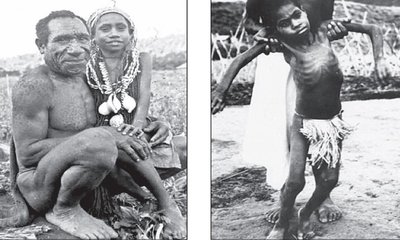 Dr N Someshwara Column: ಅವರು ನಕ್ಕು ನಕ್ಕು ಸಾಯುತ್ತಿದ್ದರು !