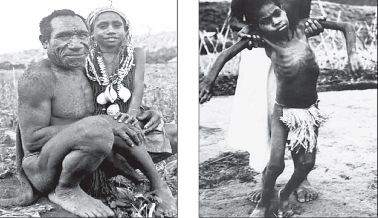 Dr N Someshwara Column: ಅವರು ನಕ್ಕು ನಕ್ಕು ಸಾಯುತ್ತಿದ್ದರು !