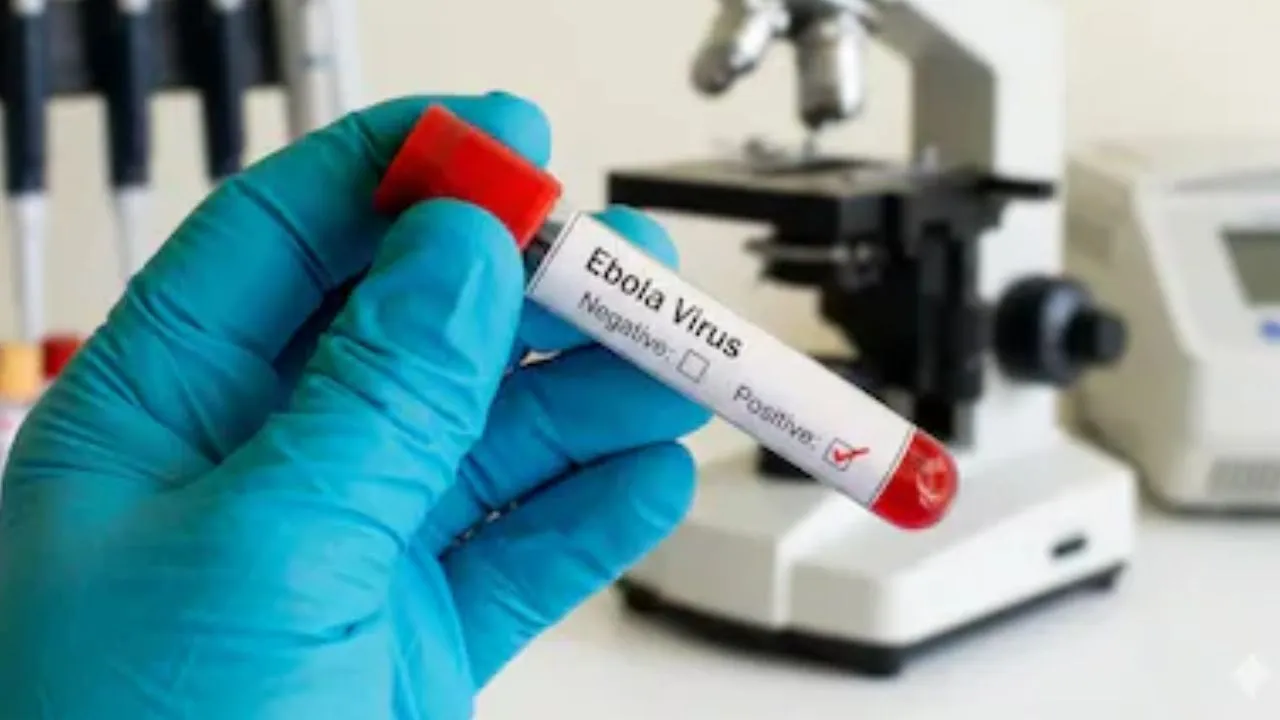 Ebola outbreak: ಎಬೋಲಾ ವೈರಸ್‌ ಆತಂಕ ಹಿನ್ನೆಲೆ ರಾಜ್ಯದಲ್ಲಿ ಹೈ ಅಲರ್ಟ್‌; ಮಾರ್ಗಸೂಚಿ ಪ್ರಕಟ