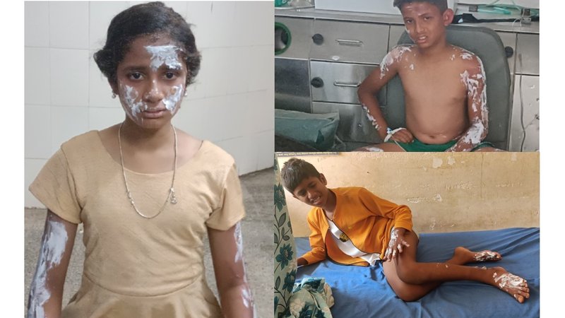 Gas Cylinder Blast 1