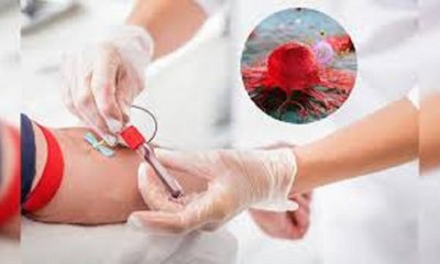 ಸ್ಕ್ಯಾನಿಂಗ್ ರಿಪೋರ್ಟ್‌ನಲ್ಲಿ 'ಗೆಡ್ಡೆ' ಎಂದಿದೆಯೇ? ಆತಂಕ ಬೇಡ