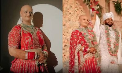 ರೂಪಕ್ಕಿಂತ ಗುಣವೇ ಮೇಲು: ಬೋಳು ತಲೆಯಲ್ಲೇ ಹಸೆಮಣೆಗೇರಿದ ವಧು