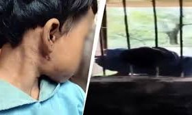 ಶಾಲೆಯ ಕಿಟಕಿಯಲ್ಲಿ ಸಿಲುಕಿದ್ದ 8 ವರ್ಷದ ಬಾಲಕಿ ತಲೆ