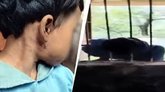 ಶಾಲೆಯ ಕಿಟಕಿಯಲ್ಲಿ ಸಿಲುಕಿದ್ದ 8 ವರ್ಷದ ಬಾಲಕಿ ತಲೆ