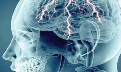 ಮೂರ್ಛೆರೋಗ ಚಿಕಿತ್ಸೆಯಲ್ಲಿ ಮಹತ್ತರ ಆವಿಷ್ಕಾರಗಳು