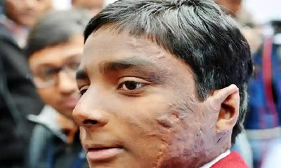 ಬೆಂಕಿ ಹತ್ತಿದ ಬಸ್ಸಿಗೆ ನುಗ್ಗಿ ಮಕ್ಕಳ ಪ್ರಾಣ ಉಳಿಸಿದ 11ರ ಹುಡುಗ