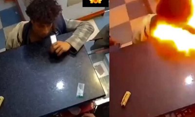 ಲಿಥಿಯಂ ಫೋನ್ ಬ್ಯಾಟರಿ ಸ್ಫೋಟ; ಬಾಲಕನಿಗೆ ತೀವ್ರ ಗಾಯ!