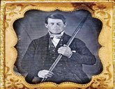 ಸಿಡಿಮದ್ದು ಸ್ಫೋಟಕ್ಕೆ ಕಬ್ಬಿಣದ ಸರಳು ಮಿದುಳನ್ನು ಹೊಕ್ಕಿತು !