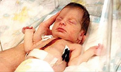 ಮಂಗನ ಹೃದಯವನ್ನು ಮಗುವಿಗೆ ಬದಲಿ ಜೋಡಿಸಿದರು !