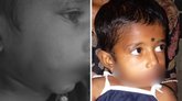4 ವರ್ಷದ ಬಾಲಕಿಯ ಮೇಲೆ ಬೀದಿ ನಾಯಿಗಳ ದಾಳಿ