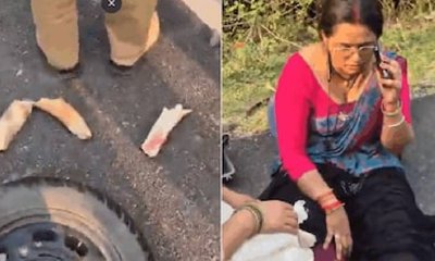 ಪ್ರಾಣಿಗಳು ಸಹ ಸುರಕ್ಷಿತವಲ್ಲ: ಸ್ಕೂಟರ್ ಡಿಕ್ಕಿಯಾಗಿ ಆನೆಯ ದಂತವೇ ಕಟ್