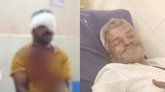 ಟೊಮೇಟೊ ತೋಟದಲ್ಲಿ ಕರಡಿ ದಾಳಿ; ಇಬ್ಬರು ರೈತರಿಗೆ ಗಂಭೀರ ಗಾಯ