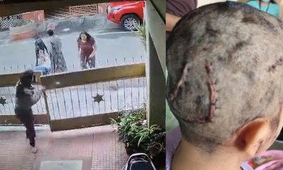 ಬೆಂಗಳೂರಿನ ಟೆಕ್ಕಿ ಮೇಲೆ ನಾಯಿ ದಾಳಿ