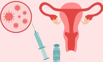 ಗರ್ಭಕಂಠದ ಕ್ಯಾನ್ಸರ್ ಪರಿಹಾರ ಹೇಗೆ?