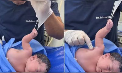 ವೈದ್ಯರ ಗ್ಲೌಸ್‌ ಹಿಡಿದ ನವಜಾತ ಶಿಶು: ಇಲ್ಲಿದೆ ಕ್ಯೂಟ್ ವಿಡಿಯೊ