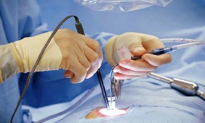 ಕ್ಯಾಮರೂನ್‌ ನ ಮಹಿಳೆಗೆ ಅತ್ಯಾಧುನಿಕ ಬೆನ್ನುಮೂಳೆ ಶಸ್ತ್ರಚಿಕಿತ್ಸೆ