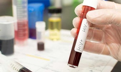 ಥಲಸ್ಸೇಮಿಯಾಗೆ ಚಿಕಿತ್ಸೆ ಪಡೆಯುತ್ತಿದ್ದ ಮಕ್ಕಳಲ್ಲಿ ಎಚ್ಐವಿ ಸೋಂಕು