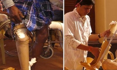 ಬೃಹತ್ ಕೃತಕ ಕಾಲು, ಕ್ಯಾಲಿಪರ್ ಹಾಗೂ ಮುಂಗೈ ಜೋಡಣಾ ಶಿಬಿರ