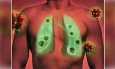 ಭಾರತದಲ್ಲಿ ಸಿಓಪಿಡಿ ಹೃದಯ-ಶ್ವಾಸಕೋಶ ಸಂಬಂಧಿ ತುರ್ತು ಸ್ಥಿತಿ ಬದಲು