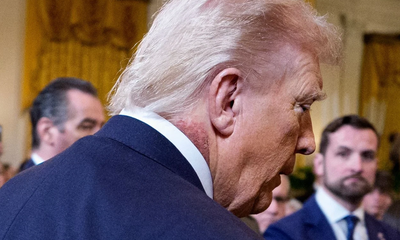 ಡೊನಾಲ್ಡ್ ಟ್ರಂಪ್ ಗೆ ಕಾಡುತ್ತಿದೆಯೇ ಅನಾರೋಗ್ಯ ?