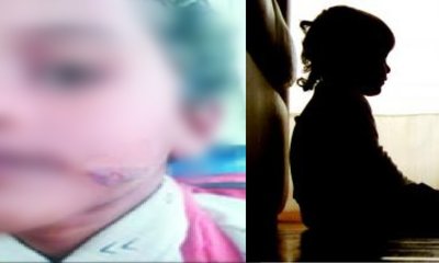 ಬರ್ಬರ ಕೃತ್ಯ, ಮಗುವಿನ ಮುಖಕ್ಕೆ ಕಾಸಿದ ಚಾಕುವಿನಿಂದ ಬರೆ ಎಳೆದ ಸಹಾಯಕಿ