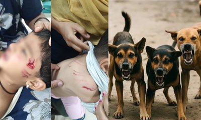 ಐದು ಮಕ್ಕಳಿಗೆ ಯದ್ವಾತದ್ವಾ ಕಚ್ಚಿ ಗಾಯಗೊಳಿಸಿದ ರಕ್ಕಸ ಬೀದಿ ನಾಯಿಗಳು