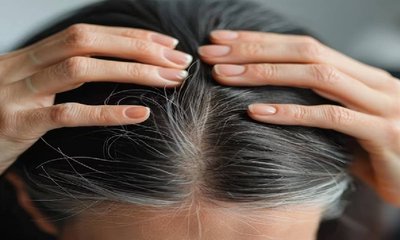 ಕೂದಲು ಬಿಳಿಯಾಗುತ್ತಿದ್ದರೆ ಪರಿಹಾರವೇನು?