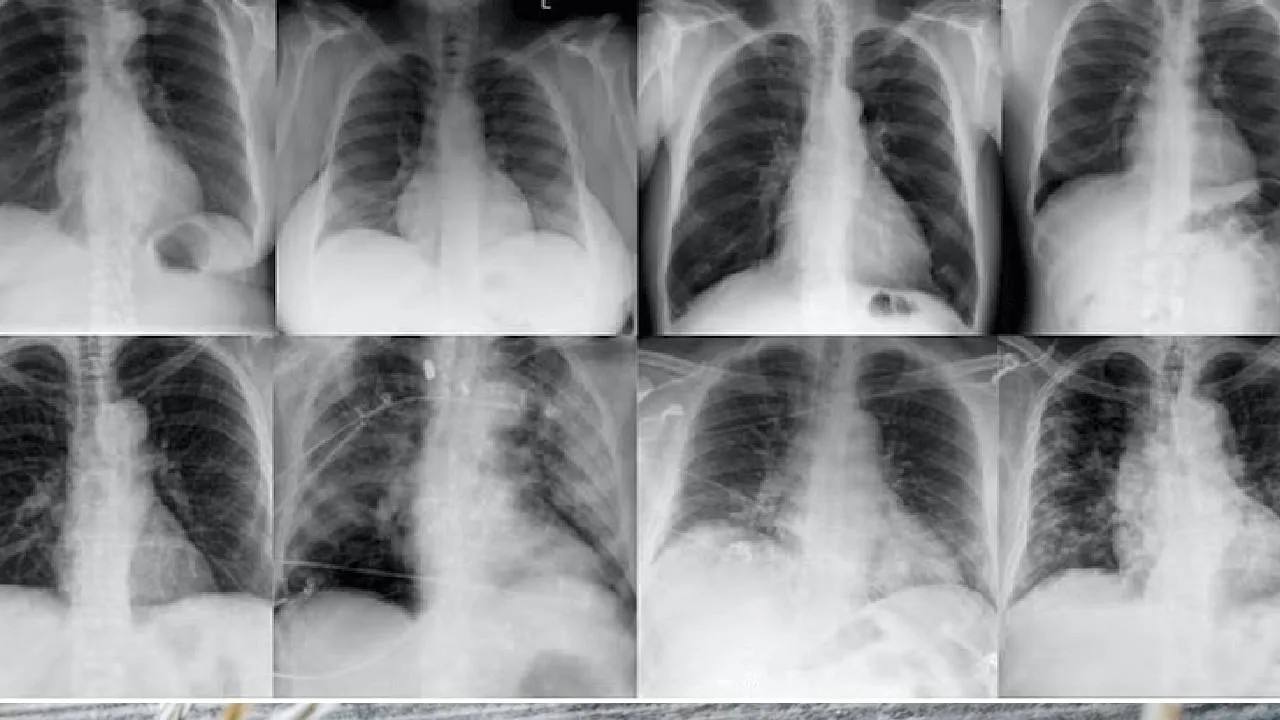 Accidental Inventions: ಫೊಟೇಟೋ ಚಿಪ್ಸ್‌ನಿಂದ ಹಿಡಿದು ವಯಾಗ್ರದವರೆಗೆ!  ಆಕಸ್ಮಿಕವಾಗಿ ಆವಿಷ್ಕಾರಗೊಂಡು ಜಗತ್ತಿನಲ್ಲಿ ಕ್ರಾಂತಿ ಮಾಡಿದ ವಸ್ತುಗಳು ಯಾವುವು ಗೊತ್ತಾ? - Image 9