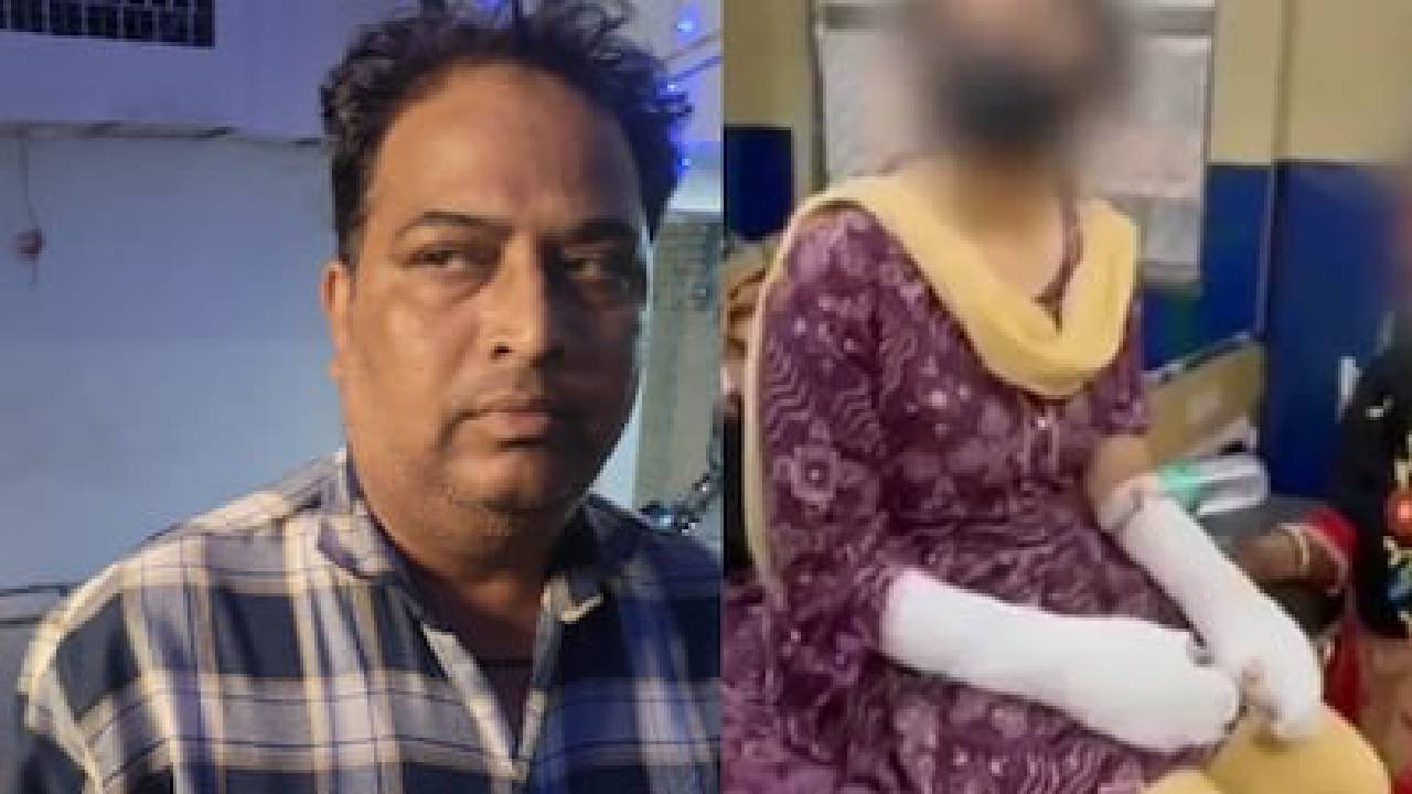 ಆಸಿಡ್ ದಾಳಿ ಕೇಸ್; ಯುವತಿಯ ತಂದೆ ಮೇಲೆ ಬಿತ್ತು ಕೇಸ್