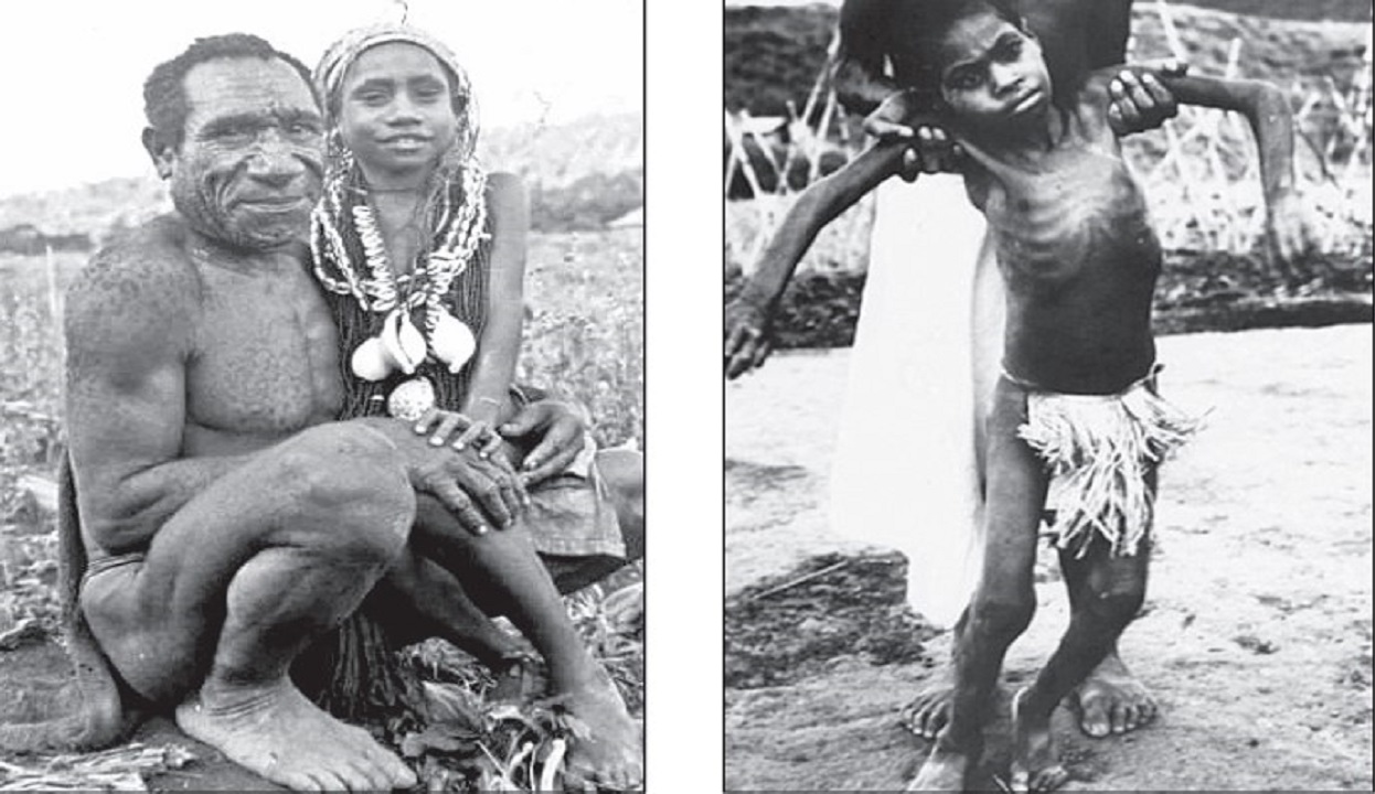 Dr N Someshwara Column: ಅವರು ನಕ್ಕು ನಕ್ಕು ಸಾಯುತ್ತಿದ್ದರು !