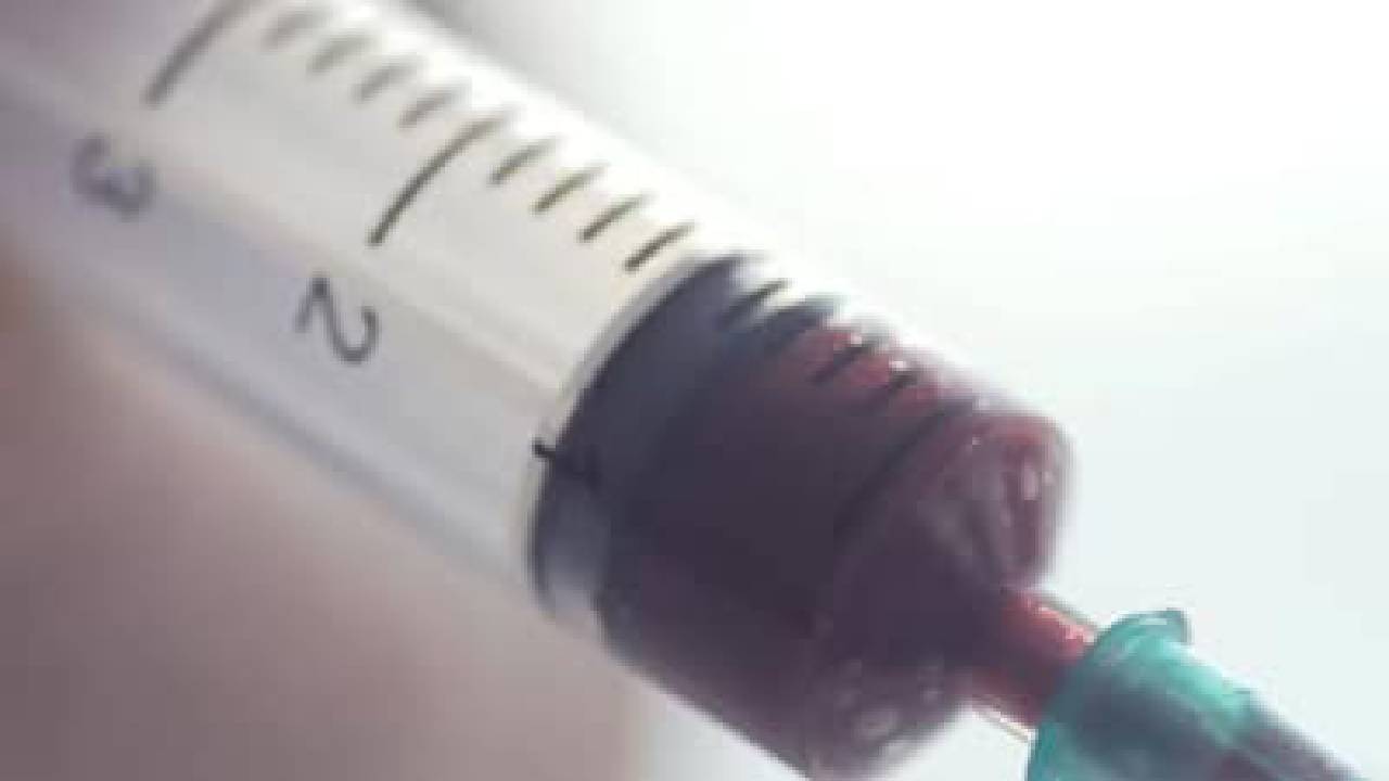 5 ಮಕ್ಕಳ ನಂತರ, ಈಗ ನಾಲ್ವರು ರಕ್ತದಾನಿಗಳಿಗೆ HIV ಪಾಸಿಟಿವ್