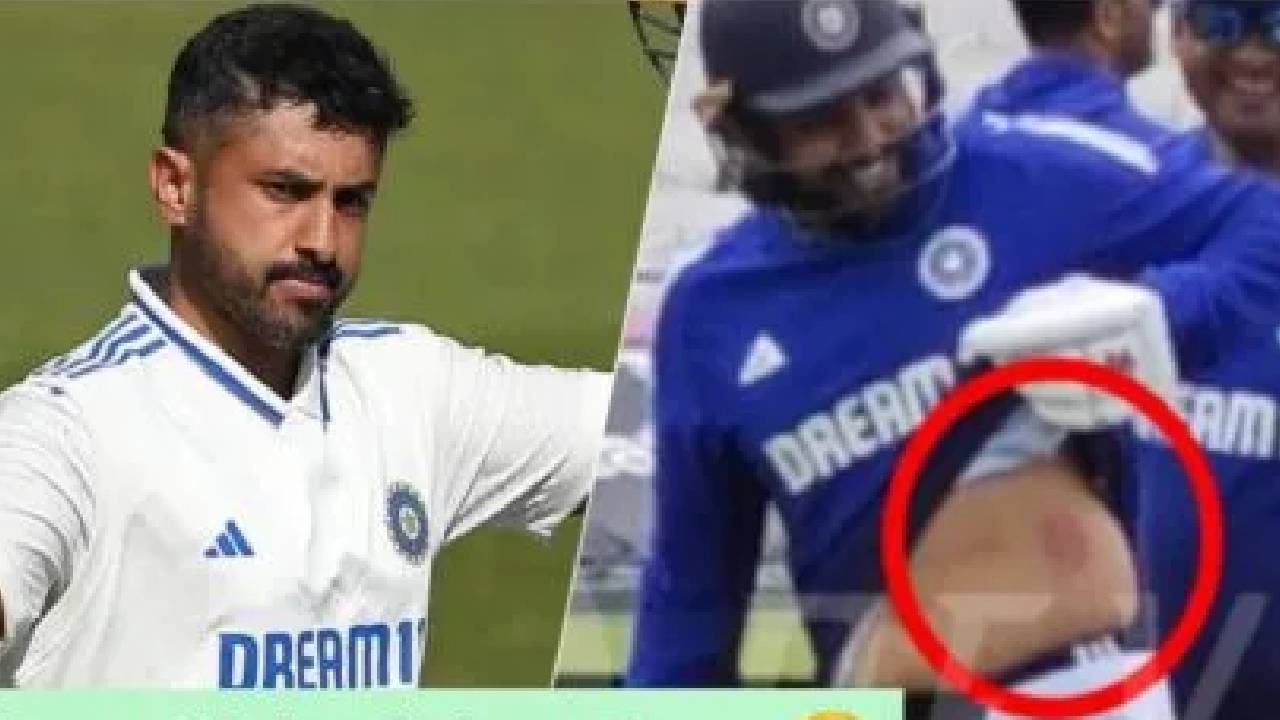 ಅಭ್ಯಾಸದ ವೇಳೆ ಗಾಯ; ಮೊದಲ ಟೆಸ್ಟ್ಗೆ ಕರುಣ್ ನಾಯರ್ ಅನುಮಾನ!