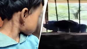 ಶಾಲೆಯ ಕಿಟಕಿಯಲ್ಲಿ ಸಿಲುಕಿದ್ದ 8 ವರ್ಷದ ಬಾಲಕಿ ತಲೆ