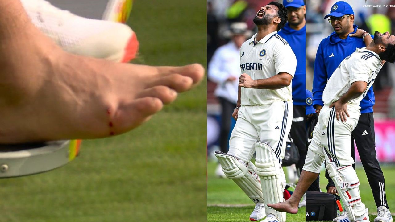 IND vs ENG: ಬ್ಯಾಟಿಂಗ್‌ ವೇಳೆ ಗಂಭೀರ ಗಾಯಕ್ಕೆ ತುತ್ತಾಗಿ ಮೈದಾನ ತೊರೆದ ರಿಷಭ್‌ ಪಂತ್‌!