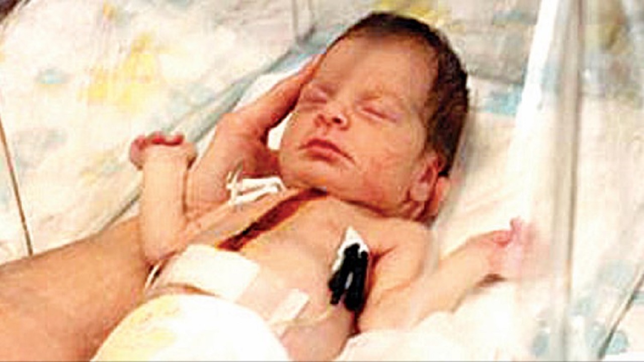 ಮಂಗನ ಹೃದಯವನ್ನು ಮಗುವಿಗೆ ಬದಲಿ ಜೋಡಿಸಿದರು !