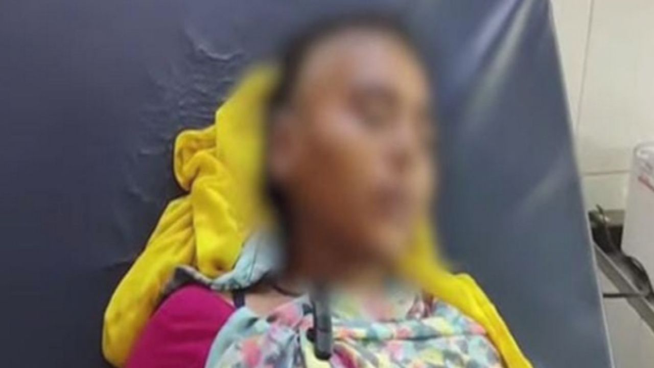 ಕಂಠಪೂರ್ತಿ ಕುಡಿದು ಪತ್ನಿ ತಲೆ ಬೋಳಿಸಿದ ಪತಿರಾಯ!