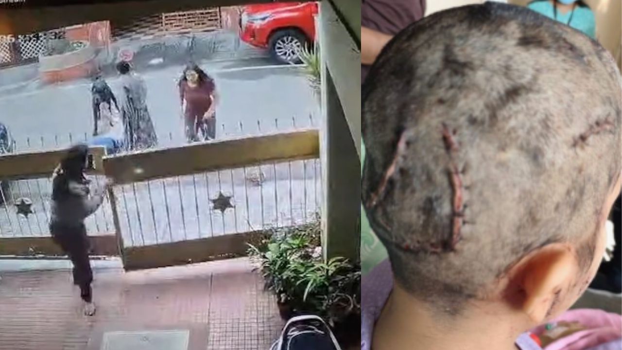 ಬೆಂಗಳೂರಿನ ಟೆಕ್ಕಿ ಮೇಲೆ ನಾಯಿ ದಾಳಿ