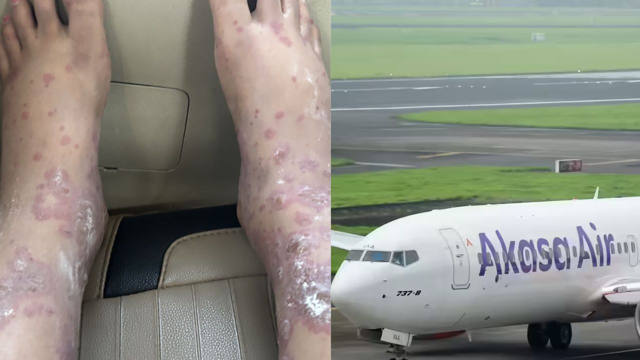 ಆಕಾಶ್ ವಿಮಾನ ಪ್ರಯಾಣದಿಂದ ಸೋಂಕಿಗೆ ತುತ್ತಾದ ಮಹಿಳೆ