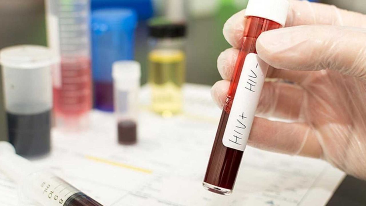 ಥಲಸ್ಸೇಮಿಯಾಗೆ ಚಿಕಿತ್ಸೆ ಪಡೆಯುತ್ತಿದ್ದ ಮಕ್ಕಳಲ್ಲಿ ಎಚ್ಐವಿ ಸೋಂಕು