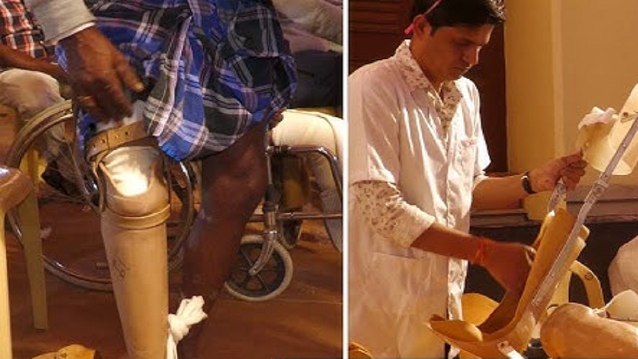 Bangalore News: ಜನವರಿ 3 ರಿಂದ 9 ರವರೆಗೆ ಬೃಹತ್ ಕೃತಕ ಕಾಲು, ಕ್ಯಾಲಿಪರ್ ಹಾಗೂ ಮುಂಗೈ ಜೋಡಣಾ ಶಿಬಿರ