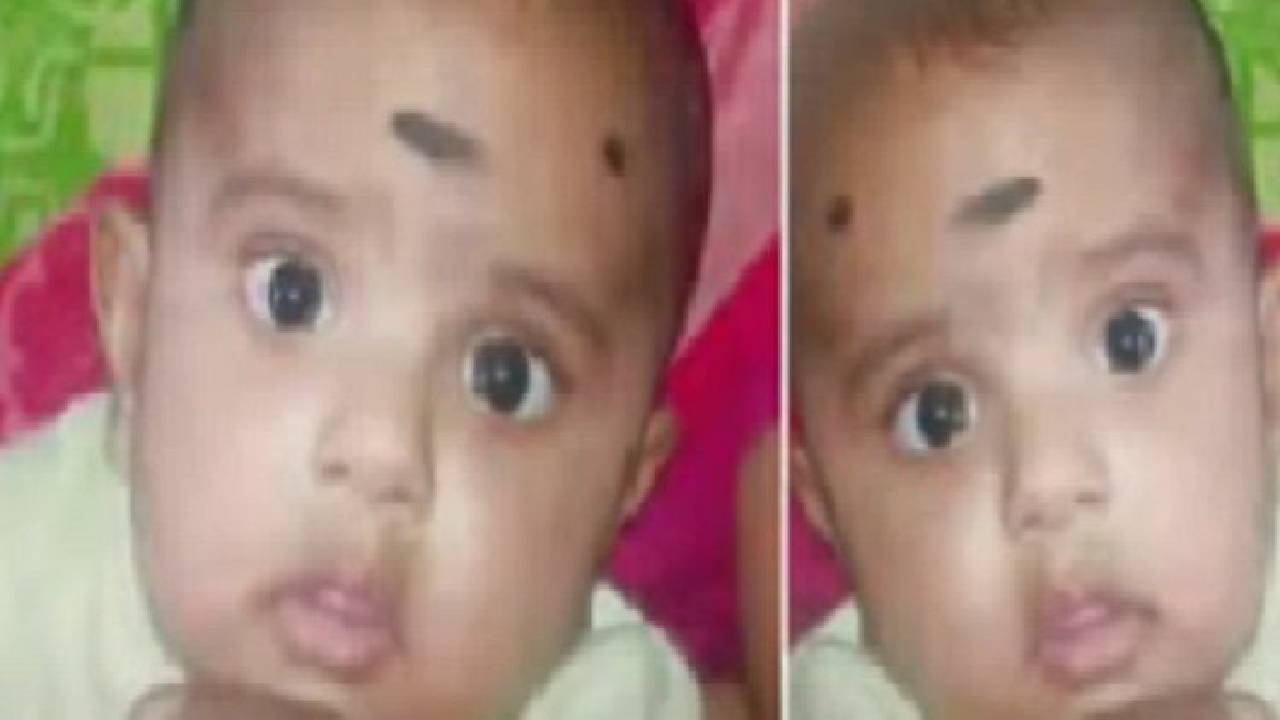 ಕಿವಿ ಚುಚ್ಚಲು ಅನಸ್ತೇಶಿಯಾ ನೀಡಿದ ವೈದ್ಯರು, 5 ತಿಂಗಳ ಮಗು ಸಾವು