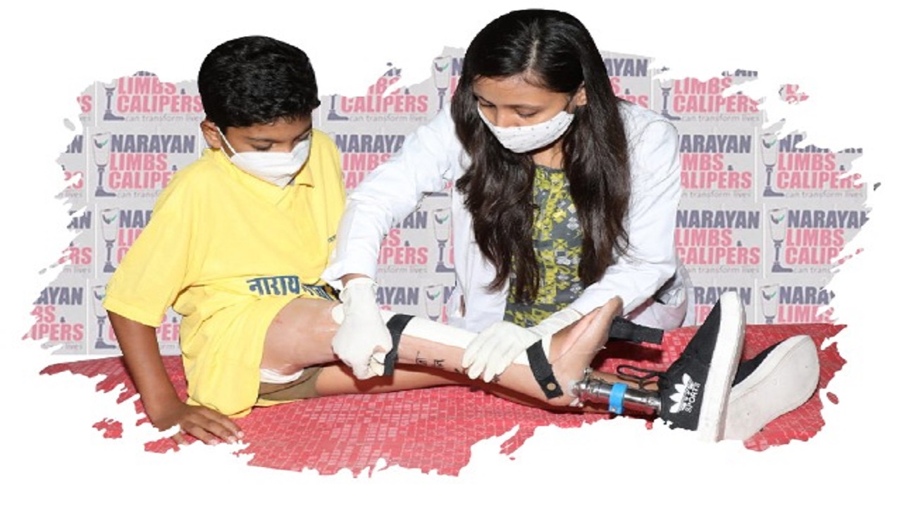 ಉಚಿತ ನಾರಾಯಣ ಕೃತಕ ಕಾಲು ಮತ್ತು ಕ್ಯಾಲಿಪರ್ ಅಳವಡಿಕೆ ಶಿಬಿರದಲ್ಲಿ 558 ವಿಕಲಚೇತನರಿಗೆ ನೆರವಾದ ನಾರಾಯಣ ಸೇವಾ ಸಂಸ್ಥಾನ