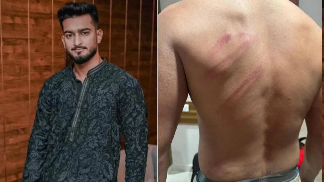 Assault Case: ಮಾಡೆಲ್‌ ಮೇಲೆ ಖಾಸಗಿ ಬಸ್‌ ಸಿಬ್ಬಂದಿ ಹಲ್ಲೆ, ಬೆಲೆಬಾಳುವ ಸ್ವತ್ತುಗಳ ಸುಲಿಗೆ