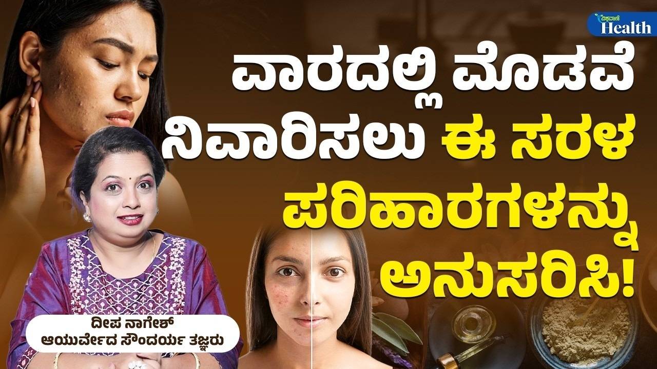 ಈ ಮನೆ ಮದ್ದನ್ನು ಬಳಸಿ ಮೊಡವೆಗೆ ಪರಿಹಾರ ಕಂಡುಕೊ‍ಳ್ಳಿ