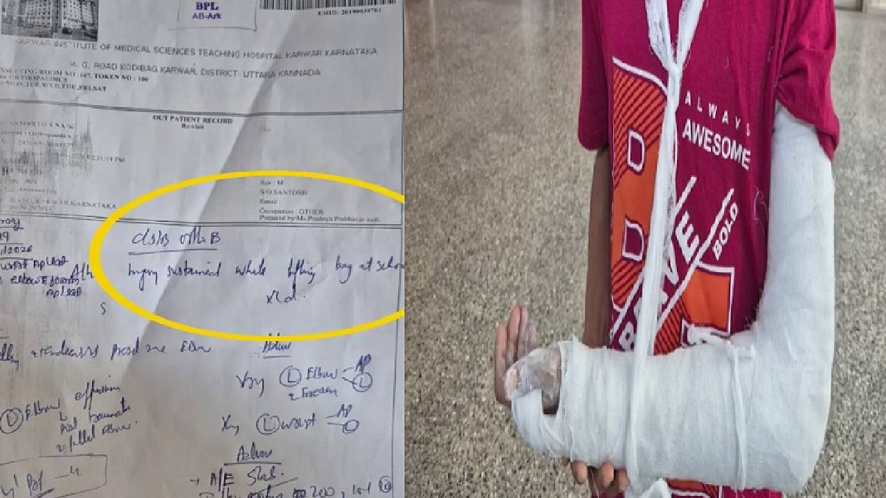 School Bag: ಅತಿ ಭಾರದ ಶಾಲಾ ಬ್ಯಾಗ್‌ ಹೊತ್ತು ವಿದ್ಯಾರ್ಥಿಯ ಕೈ ಮುರಿತ!