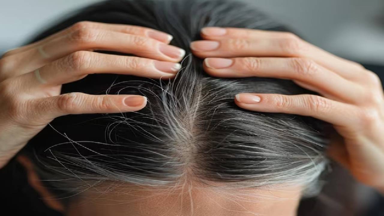 ಕೂದಲು ಬಿಳಿಯಾಗುತ್ತಿದ್ದರೆ ಪರಿಹಾರವೇನು?
